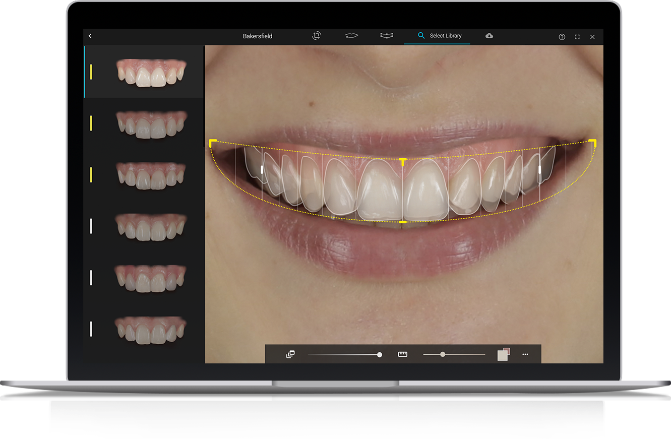 Voucher DentalVision AI